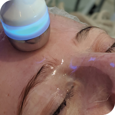 Hydrofacial